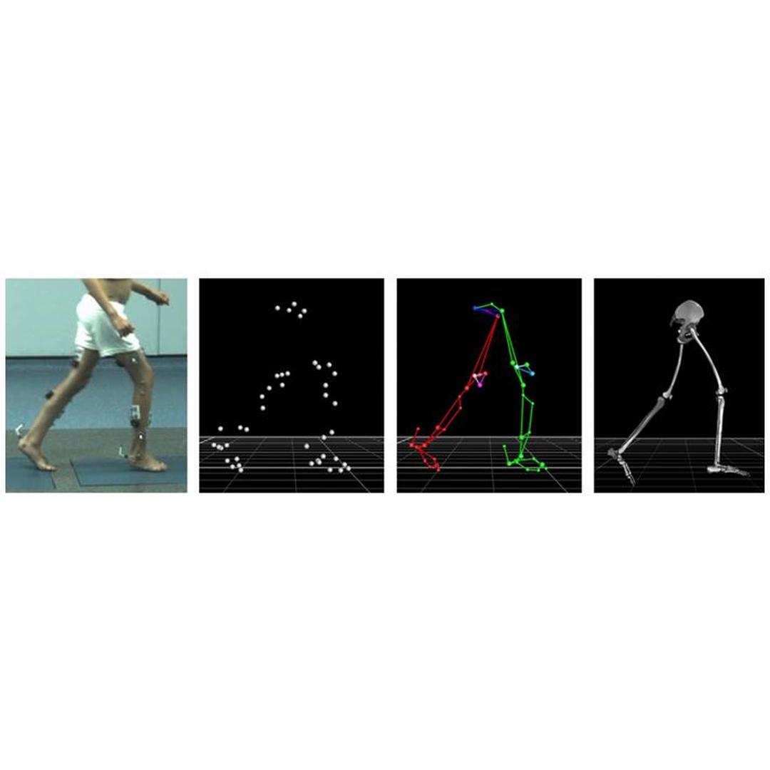 Biomechanic Gait Analysis